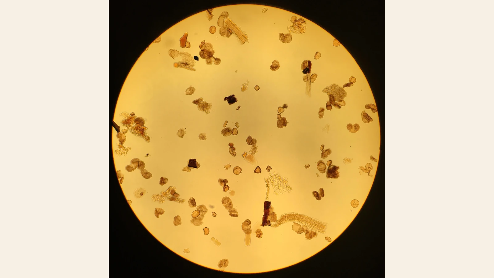 黄色い円形の顕微鏡視野に、丸みのある花粉と大きな有機物片が混在する